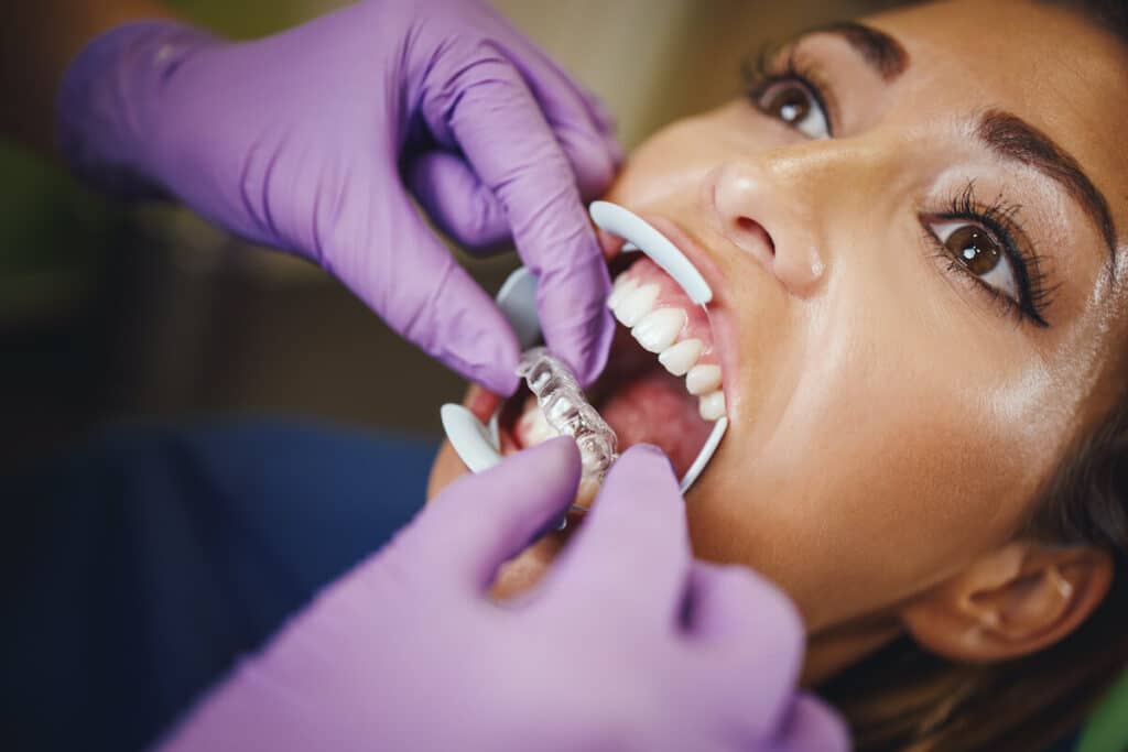 Medicaid Orthodontist Service