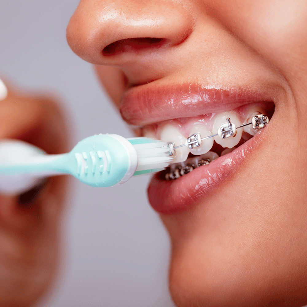 Retainers vs. Permanent Retainers Service Providers