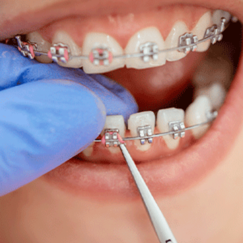 Kids Orthodontist Treatment